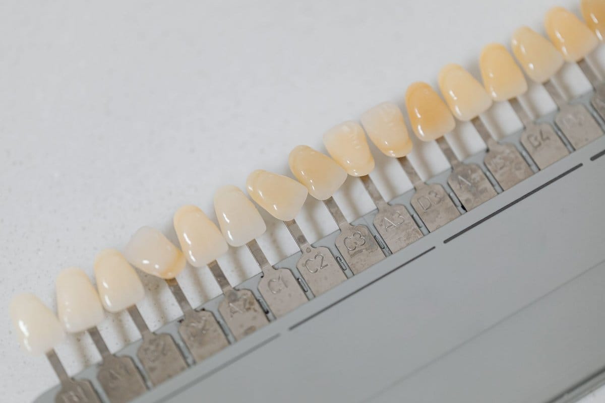 blanchir plastique jauni